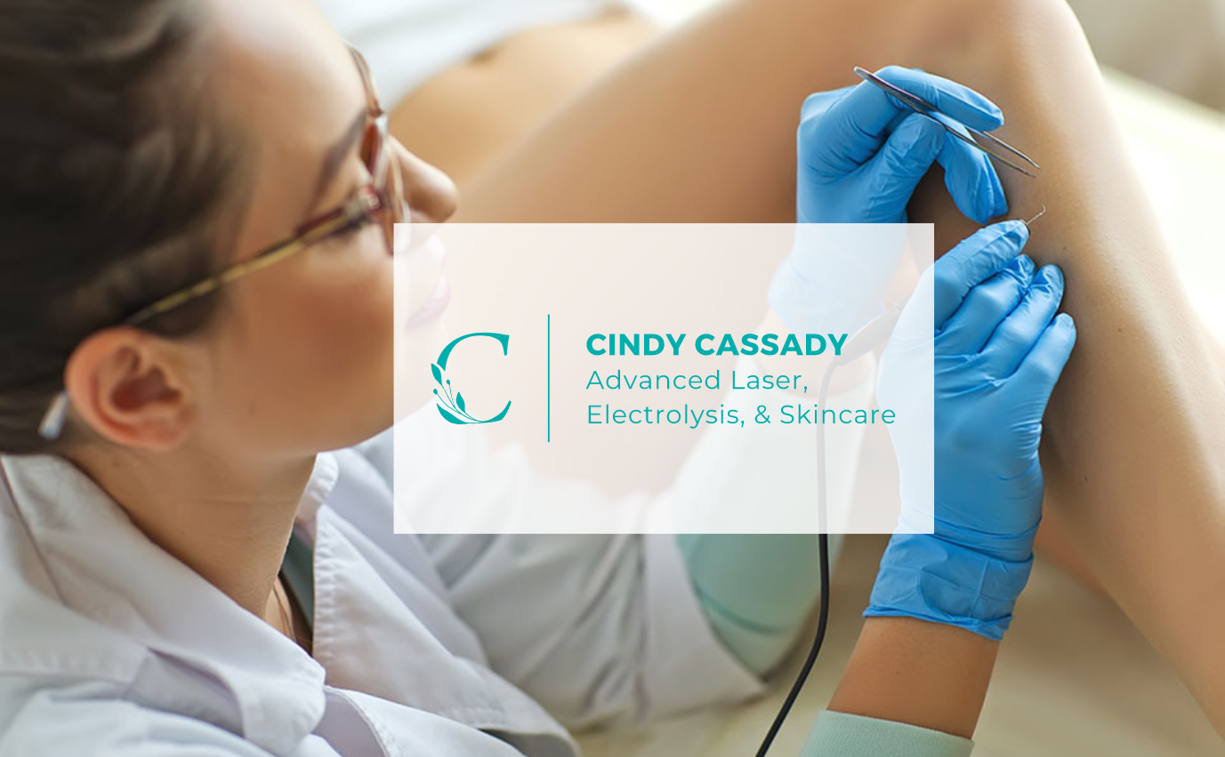 Cindy Cassady Advanced Laser Electrolysis Skin In Pensacola FL