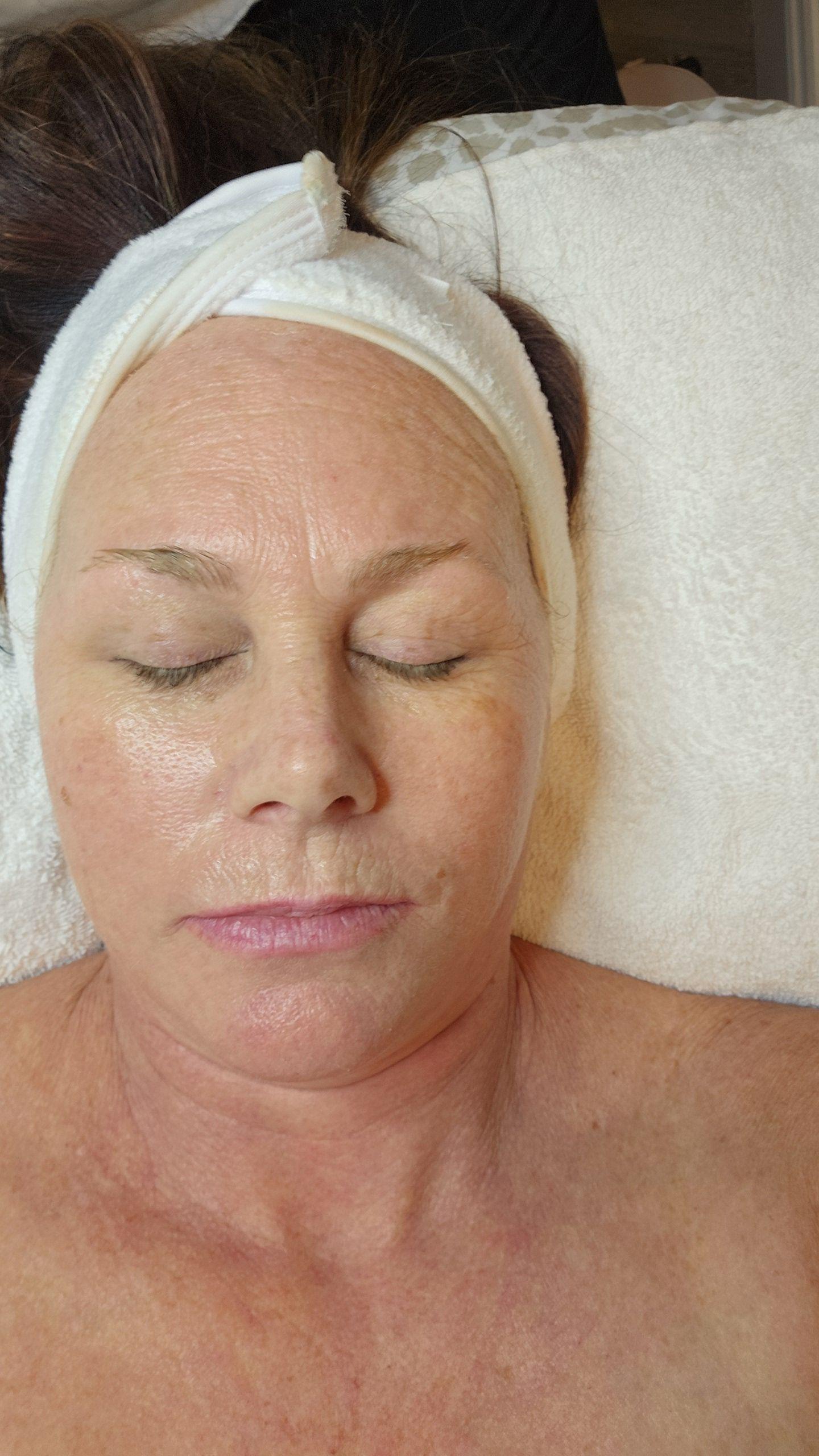 Cindy Cassady Advanced Laser Electrolysis Skin In Pensacola FL